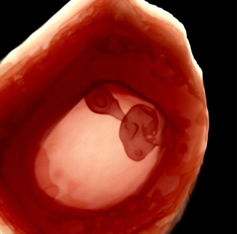 Ecografía 3D de bebé