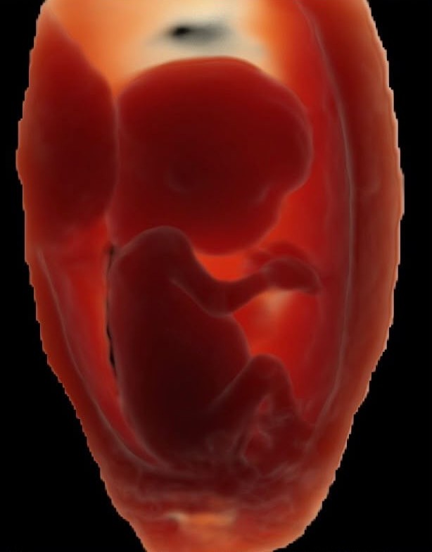 Ecografía 3D de bebé