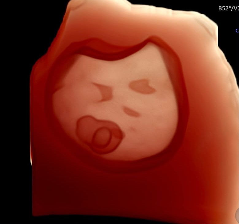 Ecografía 3D de bebé