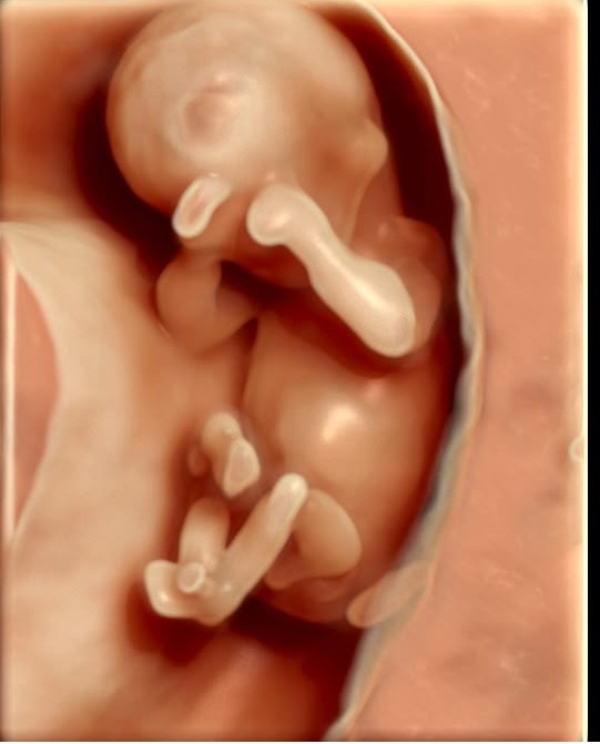 Ecografía 3D de bebé