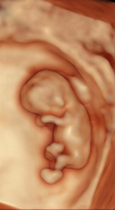 Ecografía 3D de bebé