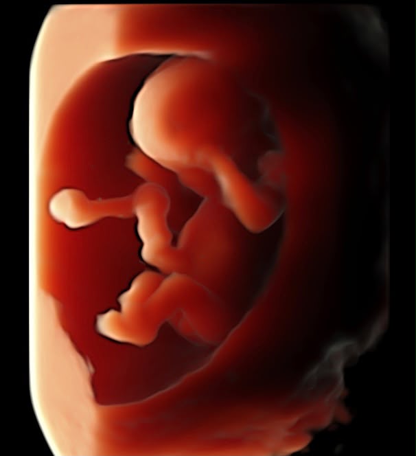 Ecografía 3D de bebé