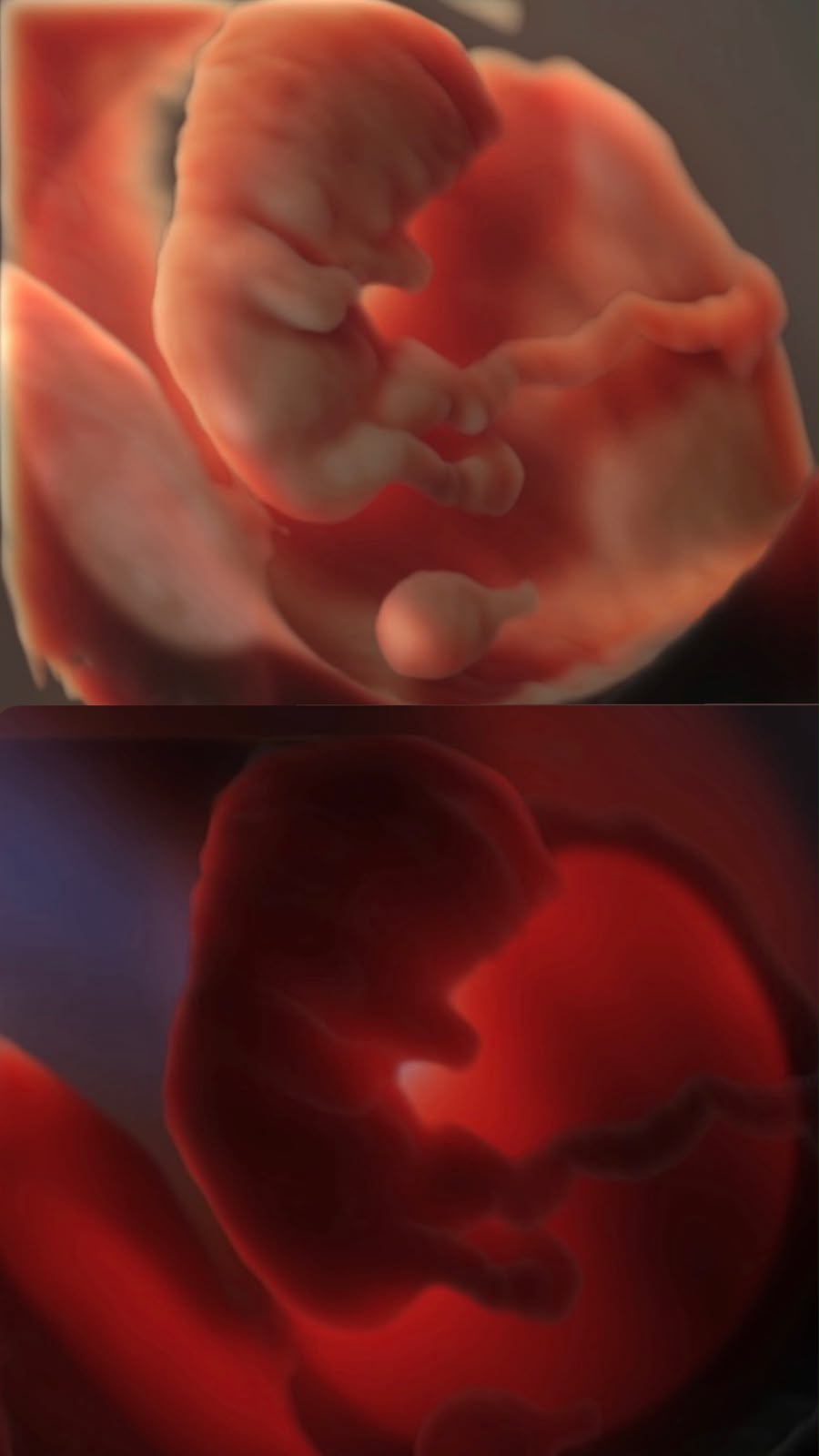 Ecografía 3D de bebé