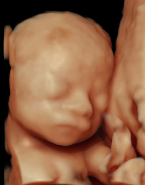 Ecografía 3D de bebé
