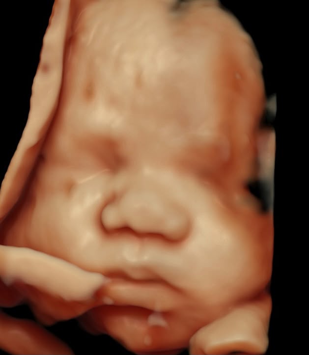 Ecografía 3D de bebé