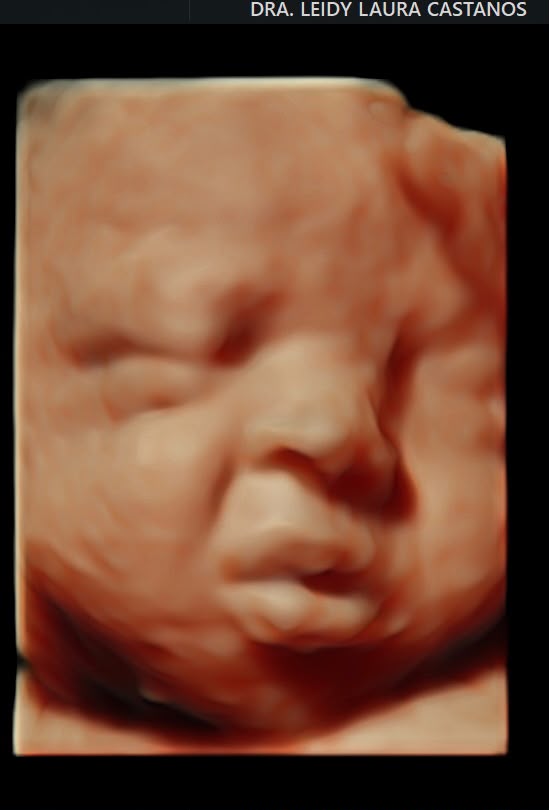 Ecografía 3D de bebé