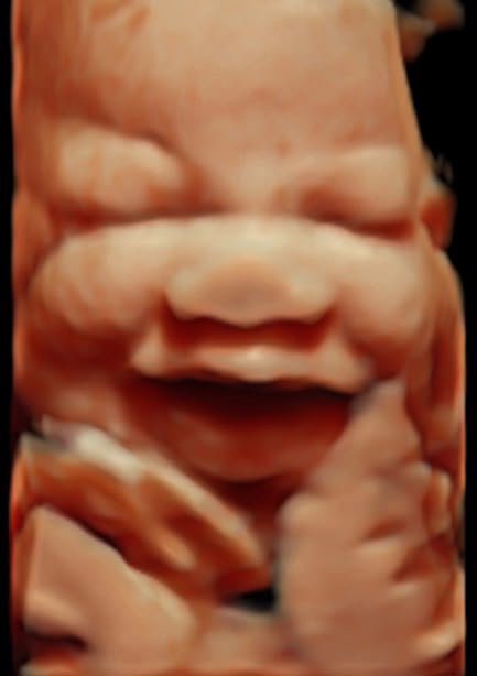 Ecografía 3D de bebé